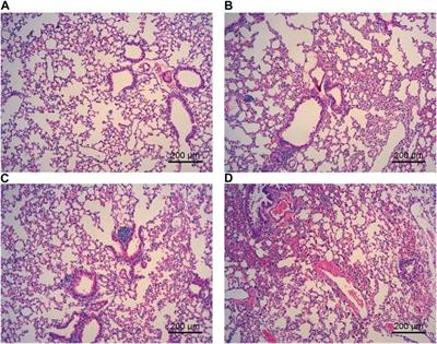 Inhalation of electronic cigarettes slightly affects lung function and inflammation in mice